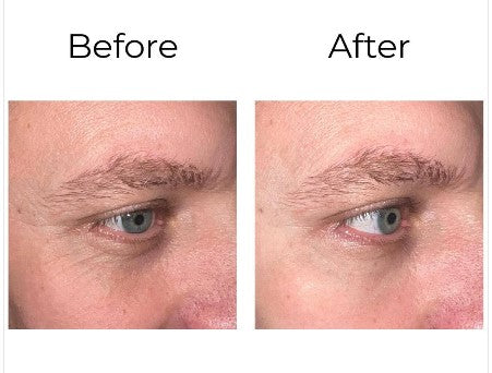 Peptilux – Crème Contour des Yeux Anti-Rides Effet Shock Action | LIPHASYN™ – 20 ml