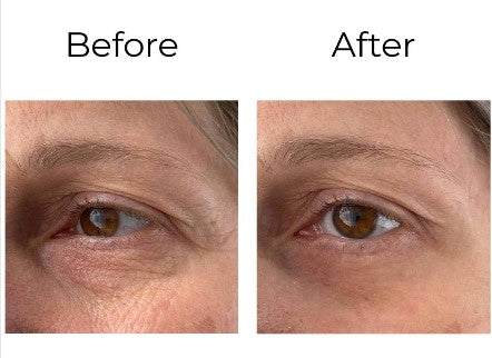 Peptilux – Crème Contour des Yeux Anti-Rides Effet Shock Action | LIPHASYN™ – 20 ml