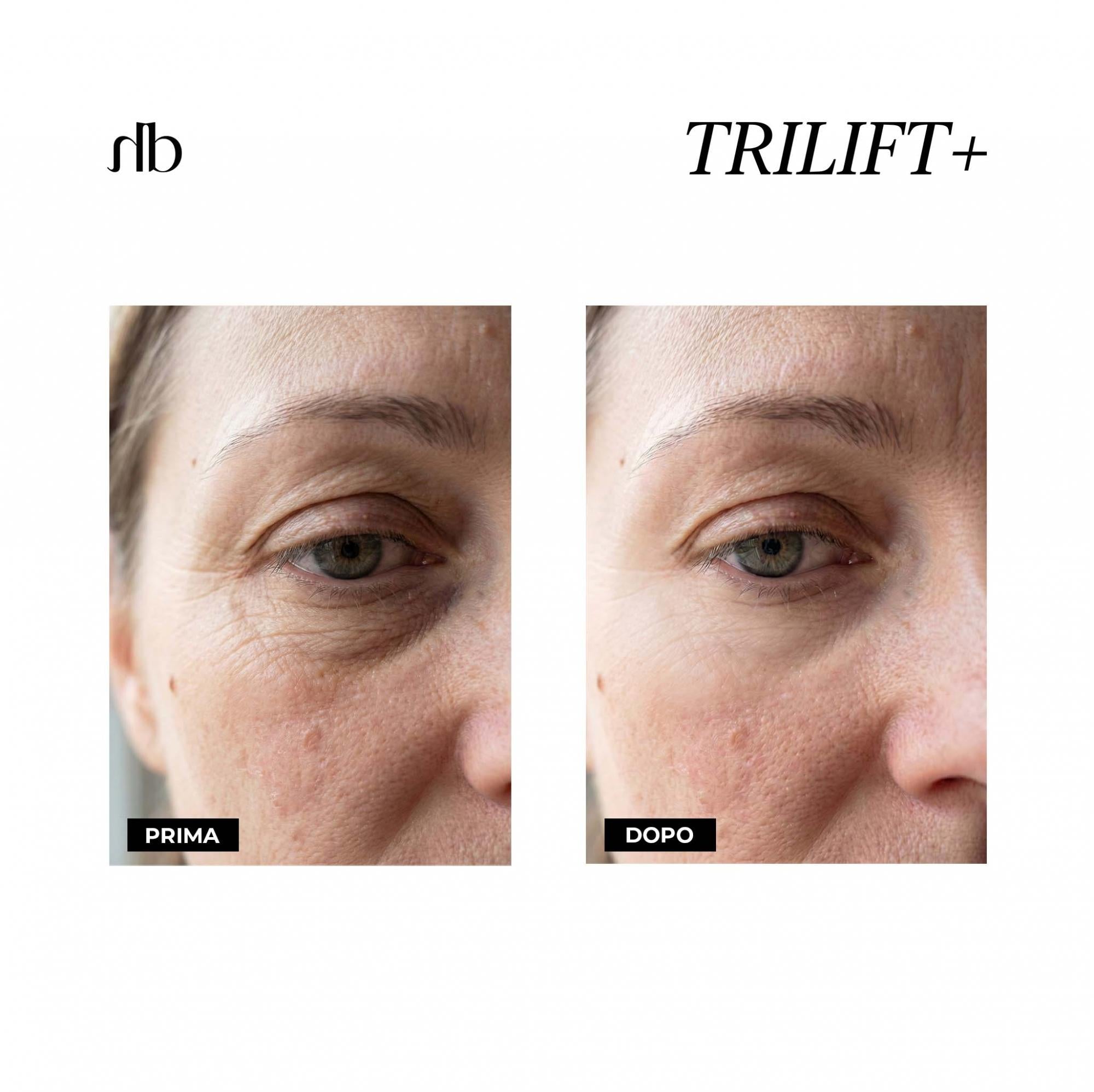 TRILIFT+ – Soin Contour des Yeux 3en1 | Halbea 10ml
