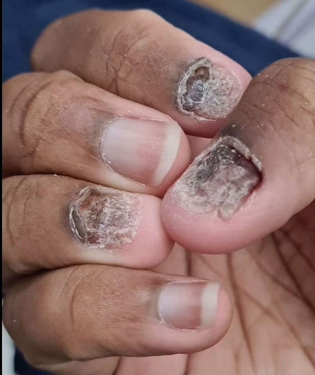 Huile nourrissante pour cuticules et ongles - 8 ml - OLCB